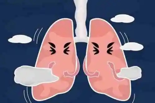 支气管肺炎可以自愈吗？