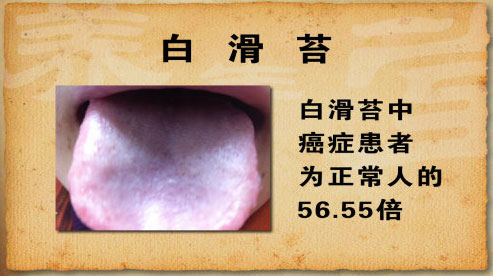 白滑苔中癌症患者为正常人的56.55倍