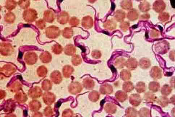 美国逾30万人感染“锥虫病” 了解锥虫病的临床表现