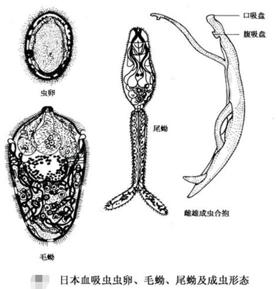 血吸虫病的症状 专家支招如何预防血吸虫病