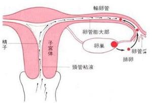 输卵管通液会引起哪些不良后果