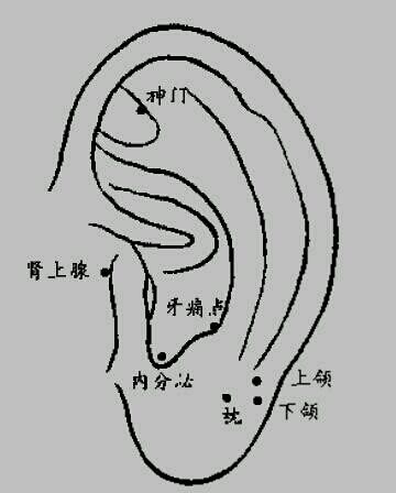 不再受牙痛折磨 分享快速止痛法