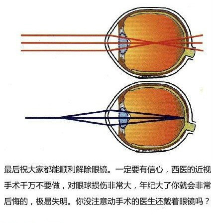 拒绝近视 中医教你近视眼怎么恢复