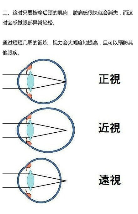 拒绝近视 中医教你近视眼怎么恢复