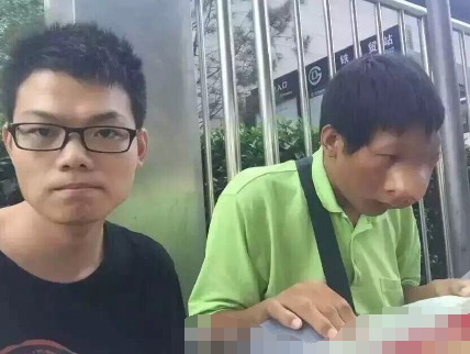 大学生患怪病面部肿大流脓 充当人肉沙包求打 