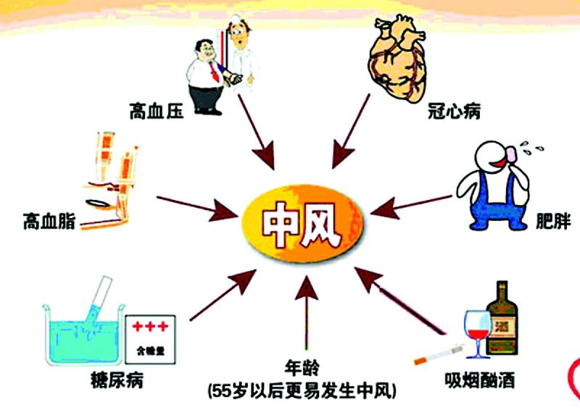 年轻人患脑中风要注意 三个自测帮你识别