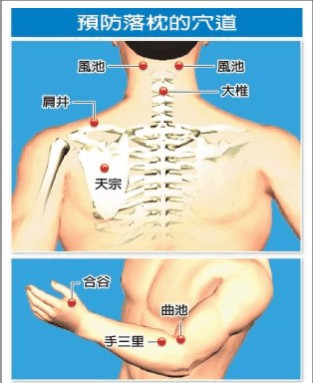 落枕了什么办法最有效 落枕的原因(5)