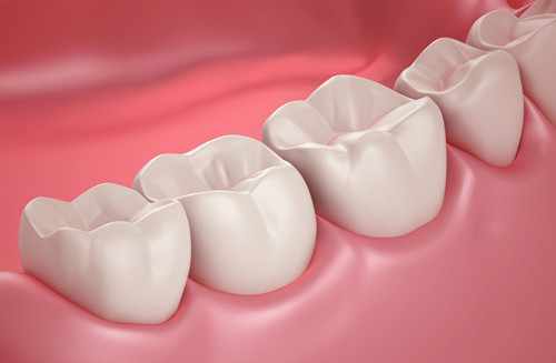 四环素牙是什么 四环素牙如何美白