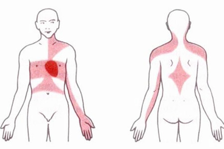 心肌缺血的症状有哪些 心肌缺血的按摩手法