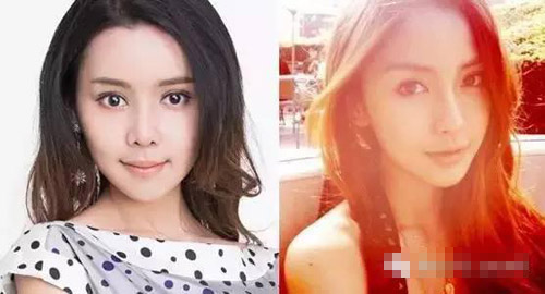 女大学生自爆整形日记 花了百万整成Angelababy(2)