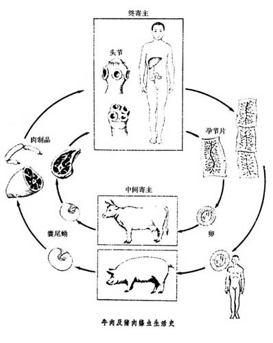 男子常吃生鱼片生牛肉 体内取出5米长牛带绦虫(5)