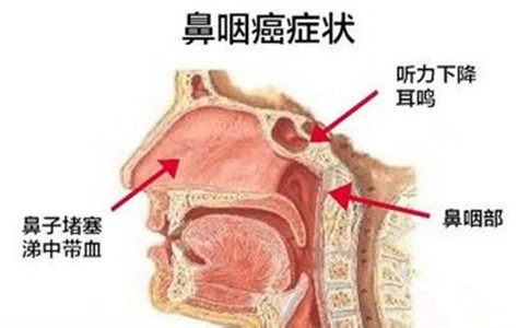 15岁男孩脖子上鼓起小包 在意时已是癌症晚期(3)