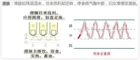 喜脉