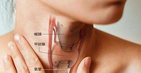 甲状腺结节是怎么回事